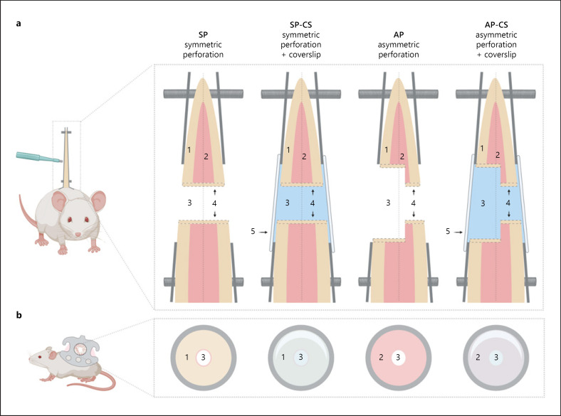 The Dorsal Skinfold Chamber as a New Tympanic Membrane Wound Healing Model: Intravital Insights into the Pathophysiology of Epithelialized Wounds.