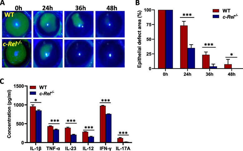 Accelerating corneal wound healing using exosome-mediated targeting of NF-κB c-Rel.