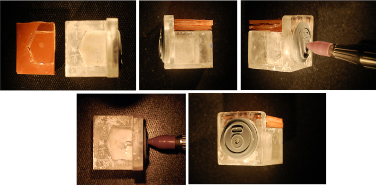 Comparison of Phacoemulsification Grooving Efficiency in Longitudinal vs Transversal Handpieces.