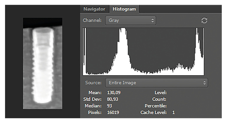 Evaluation of the different exposure parameters for the accurate diagnosis of peri-implantitis severity in digital panoramic radiography.