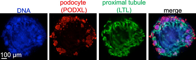 Engraftment of Kidney Organoids In Vivo.