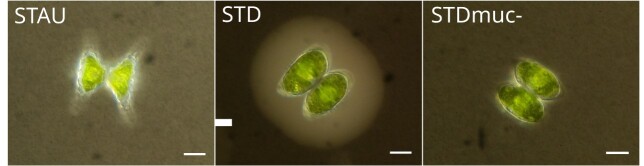 Mucilage protects the planktonic desmid <i>Staurodesmus</i> sp. against parasite attack by a chytrid fungus.