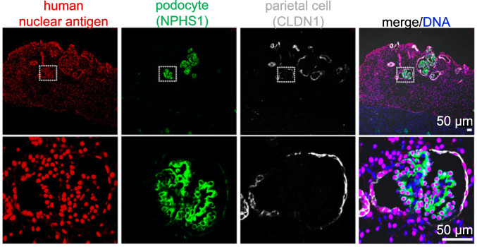 Engraftment of Kidney Organoids In Vivo.