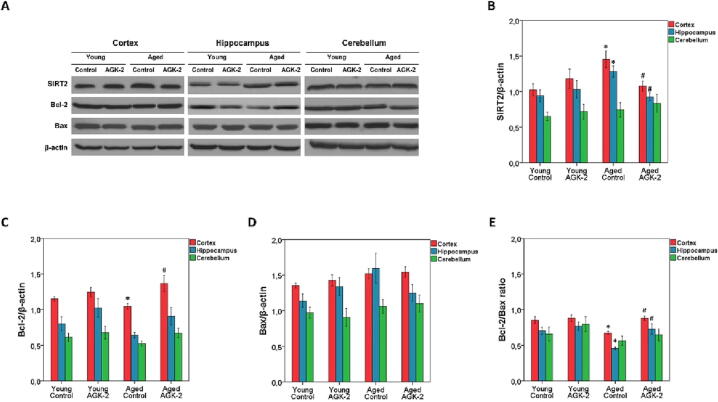 The role of SIRT2 inhibition on the aging process of brain in male rats