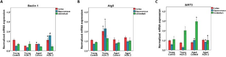 The role of SIRT2 inhibition on the aging process of brain in male rats