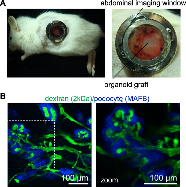 Engraftment of Kidney Organoids In Vivo.