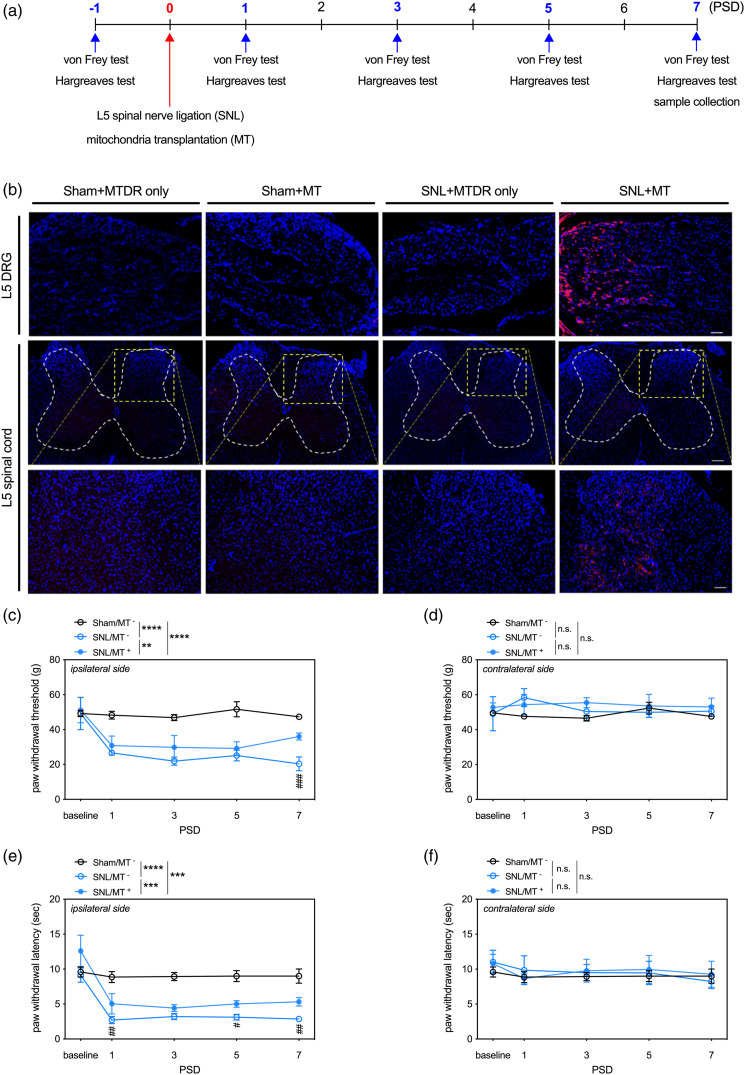 Mitochondrial transplantation attenuates traumatic neuropathic pain, neuroinflammation, and apoptosis in rats with nerve root ligation.