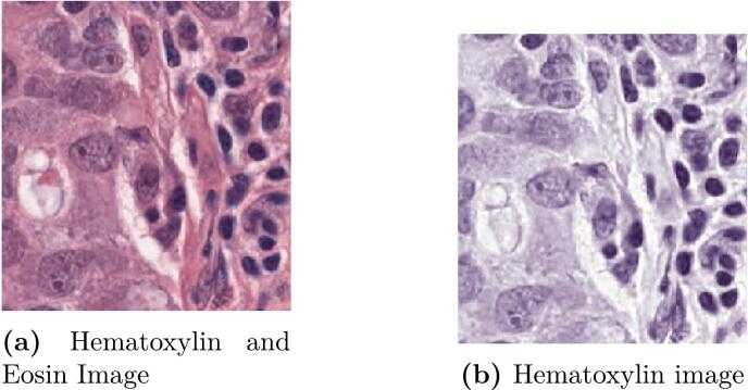 Removing non-nuclei information from histopathological images: A preprocessing step towards improving nuclei segmentation methods