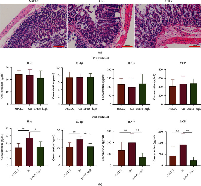 Combination of BFHY with Cisplatin Relieved Chemotherapy Toxicity and Altered Gut Microbiota in Mice.