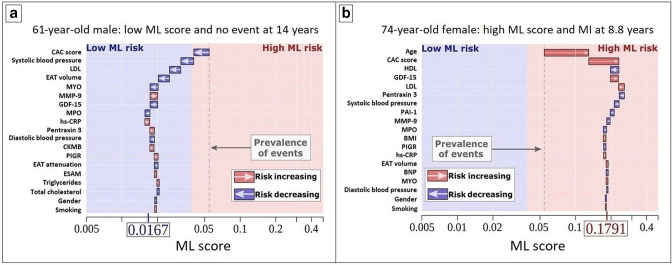 Artificial intelligence in cardiovascular imaging: enhancing image analysis and risk stratification.