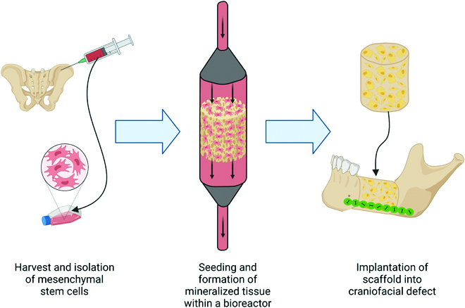 Advances in In Vitro and In Vivo Bioreactor-Based Bone Generation for Craniofacial Tissue Engineering.