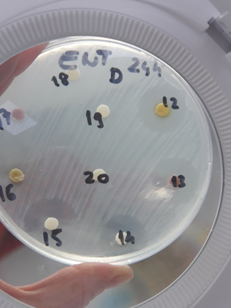 Antibacterial Effect of <i>Matricaria chamomilla</i> L. Extract Against <i>Enterococcus faecalis</i>.