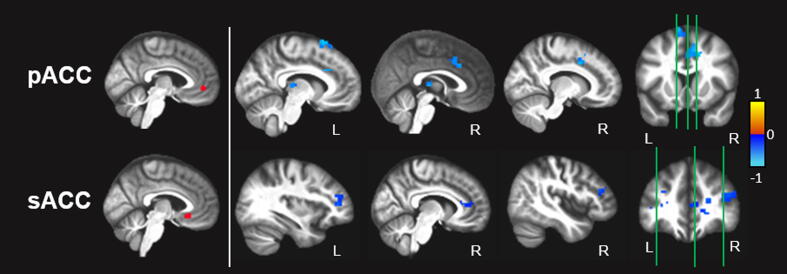 Rostral anterior cingulate connectivity in older adults with subthreshold depressive symptoms: A preliminary study