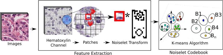 Removing non-nuclei information from histopathological images: A preprocessing step towards improving nuclei segmentation methods