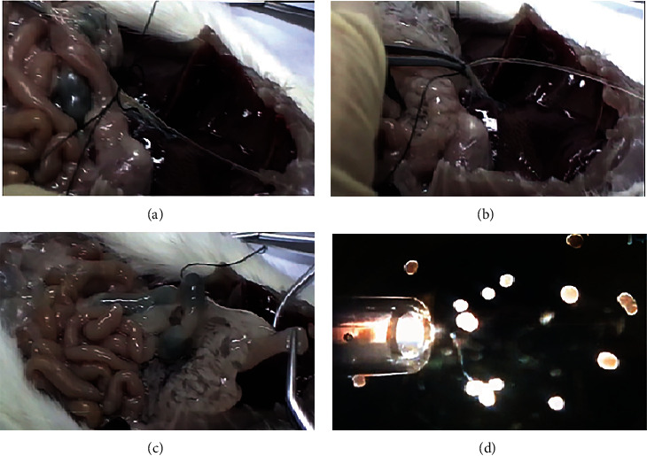 In Vitro and In Vivo Improvement of Islet Quality and Transplantation Successes following Islet Treatment with Biomaterials in Diabetic Rats.