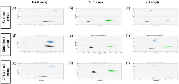 Non-invasive prenatal testing for fetal Ss, Kidd, and CTL2 blood group prediction by multiplex digital droplet PCR.