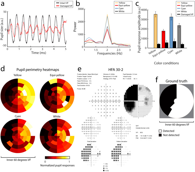 Effects of Stimulus Luminance, Stimulus Color and Intra-Stimulus Color Contrast on Visual Field Mapping in Neurologically Impaired Adults Using Flicker Pupil Perimetry.