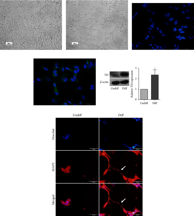 Evaluation of the Combination of Metformin and Rapamycin in an MPP<sup>+</sup>-Treated SH-SY5Y Model of Parkinson's Disease.