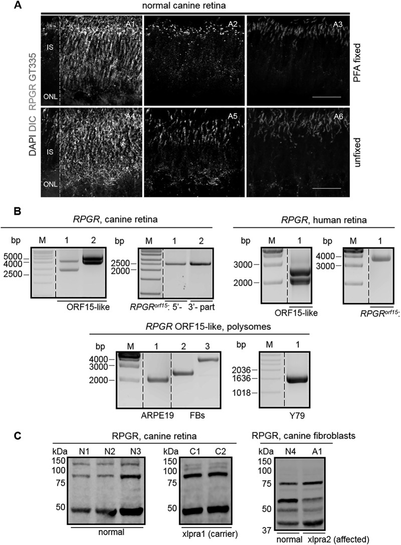 Identification of circular RNAs hosted by the <i>RPGR</i> ORF15 genomic locus.