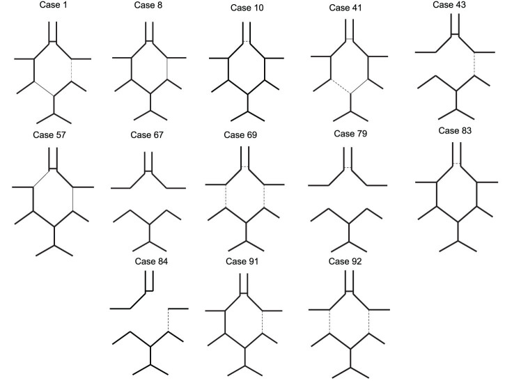 Incomplete circle of Willis as a risk factor for intraoperative ischemic events during carotid endarterectomies performed under regional anesthesia - A prospective case-series.