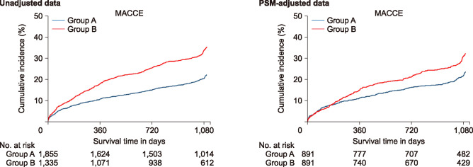 Impact of Comorbid Disease Burden on Clinical Outcomes of Female Acute Myocardial Infarction Patients.