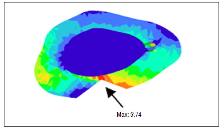 PATELLAR FRACTURE IN ANTERIOR CRUCIATE LIGAMENT RECONSTRUCTION: IN VITRO ANALYSIS.