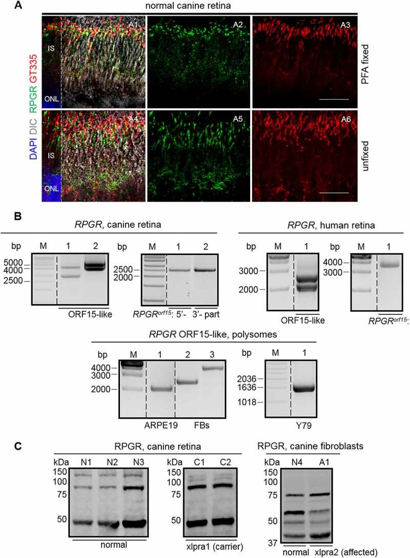 Identification of circular RNAs hosted by the <i>RPGR</i> ORF15 genomic locus.