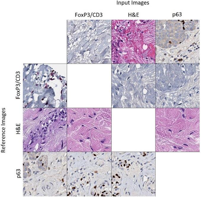 Unsupervised many-to-many stain translation for histological image augmentation to improve classification accuracy