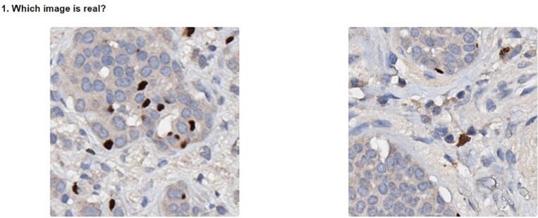 Unsupervised many-to-many stain translation for histological image augmentation to improve classification accuracy