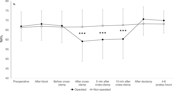 Incomplete circle of Willis as a risk factor for intraoperative ischemic events during carotid endarterectomies performed under regional anesthesia - A prospective case-series.