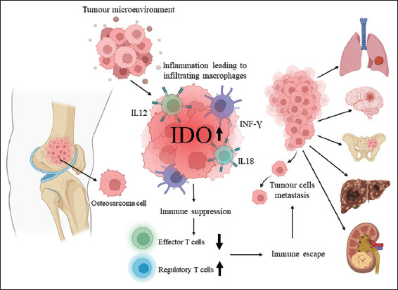 Indoleamine 2,3-Dioxygenase: A Novel Immunotherapeutic Target for Osteosarcoma.