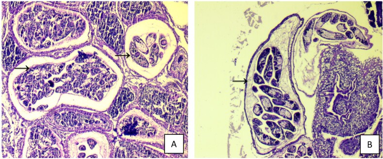 Eurytrematosis in cattle in southern Espírito Santo State, Brazil - case report.