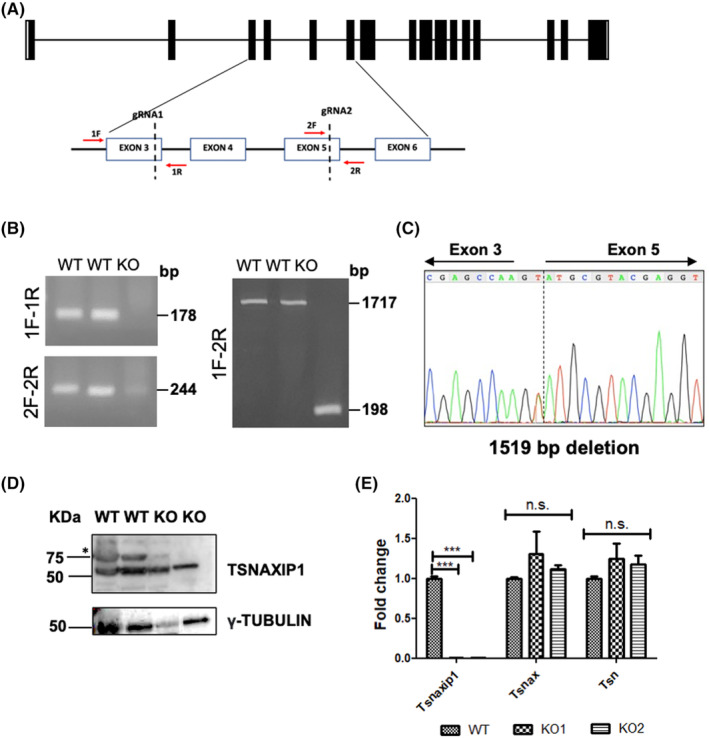 TSNAXIP1 is required for sperm head formation and male fertility.