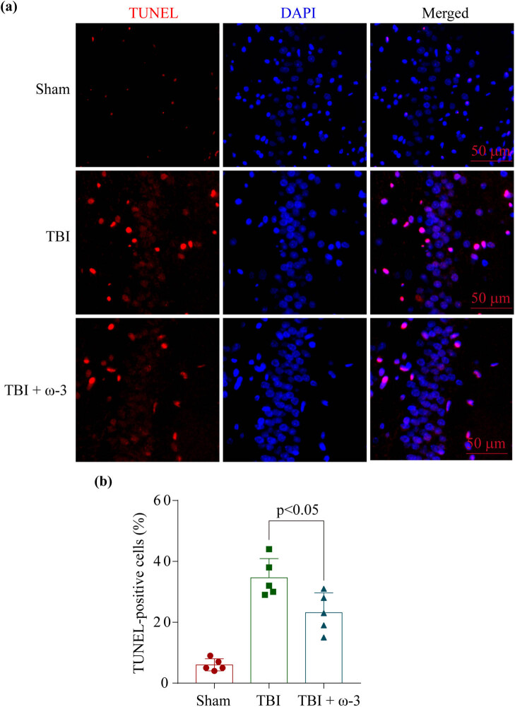 Omega-3 polyunsaturated fatty acids alleviate early brain injury after traumatic brain injury by inhibiting neuroinflammation and necroptosis.