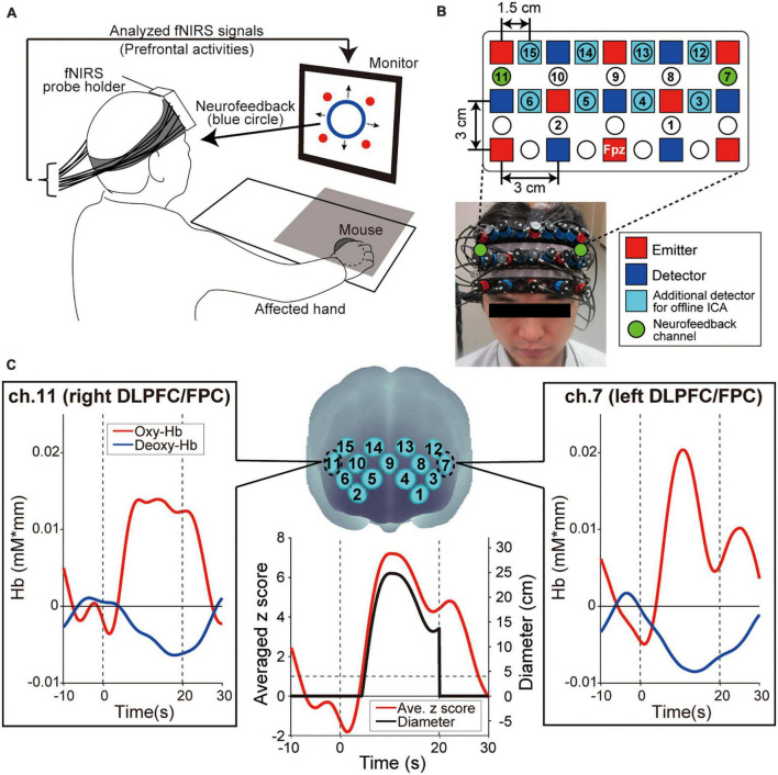 Higher prefrontal activity based on short-term neurofeedback training can prevent working memory decline in acute stroke.