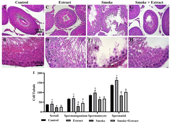 The effect of hydroalcoholic extract of <i>Cichorium intybus</i> leaf on aryl hydrocarbon receptor expression in the testis of Wistar rats exposed to cigarette smoke.