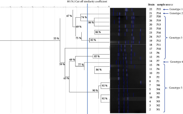 Risk Factors of Clonally Related, Multi, and Extensively Drug-Resistant <i>Acinetobacter baumannii</i> in Severely Ill COVID-19 Patients.