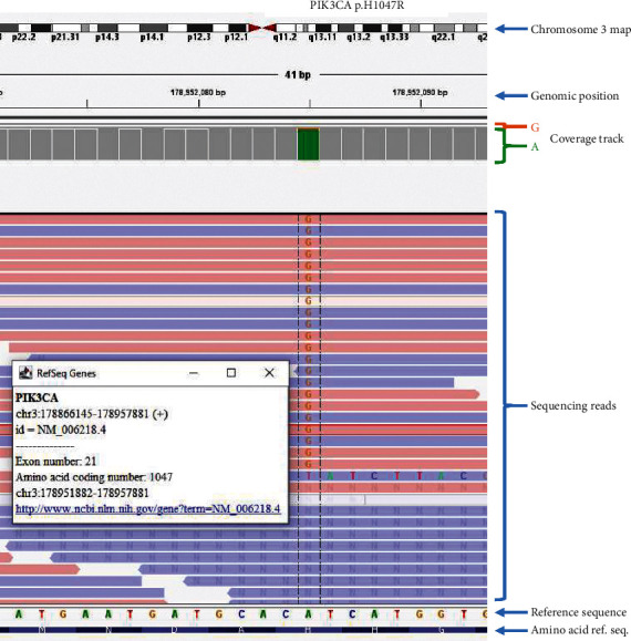 A Rare Case of Multifocal Asynchronous Benign Granular Cell Tumors with <i>PIK3CA</i> Subclonal Mutation Identified in One Tumor by Next-Generation Sequencing.