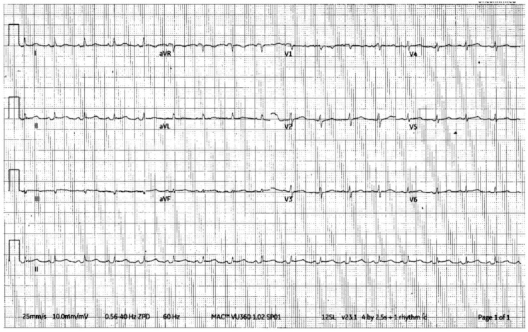 A Case of Pericarditis and Pericardial Masses Associated With Mycobacterium Paragordonae.