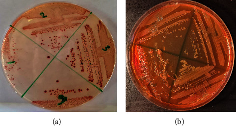 Risk Factors of Clonally Related, Multi, and Extensively Drug-Resistant <i>Acinetobacter baumannii</i> in Severely Ill COVID-19 Patients.