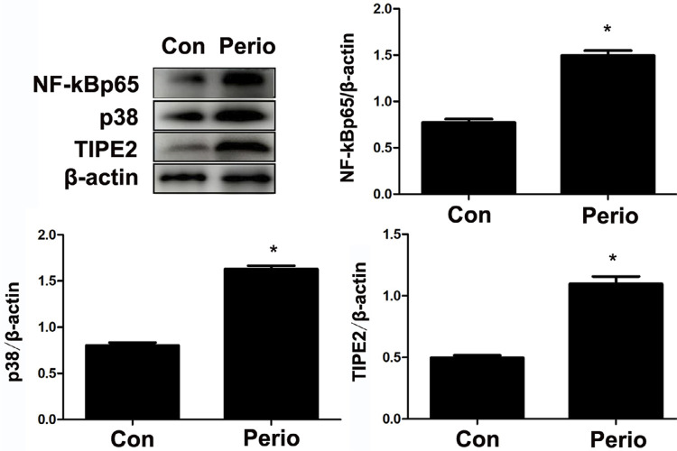 TIPE2 regulates periodontal inflammation by inhibiting NF-κB p65 phosphorylation.