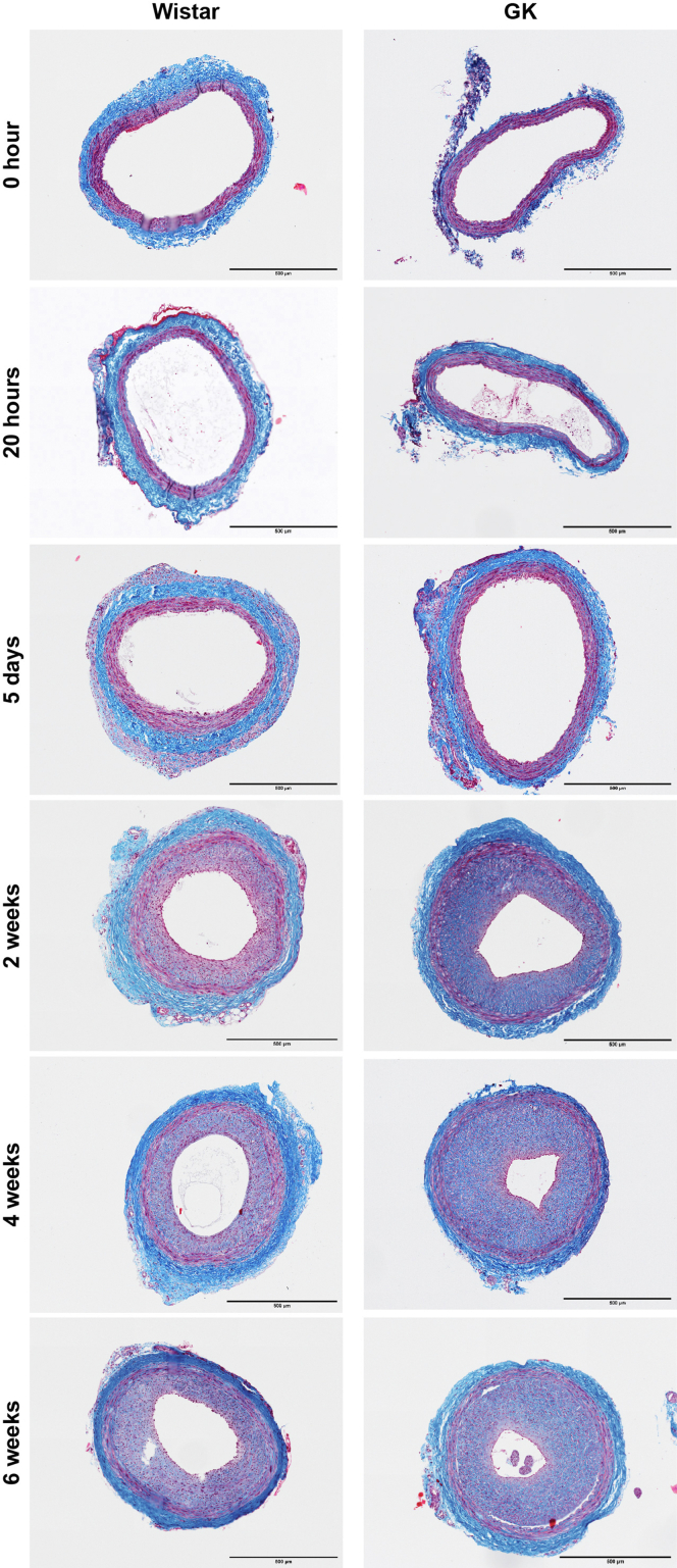 Transcriptomic and physiological analyses reveal temporal changes contributing to the delayed healing response to arterial injury in diabetic rats