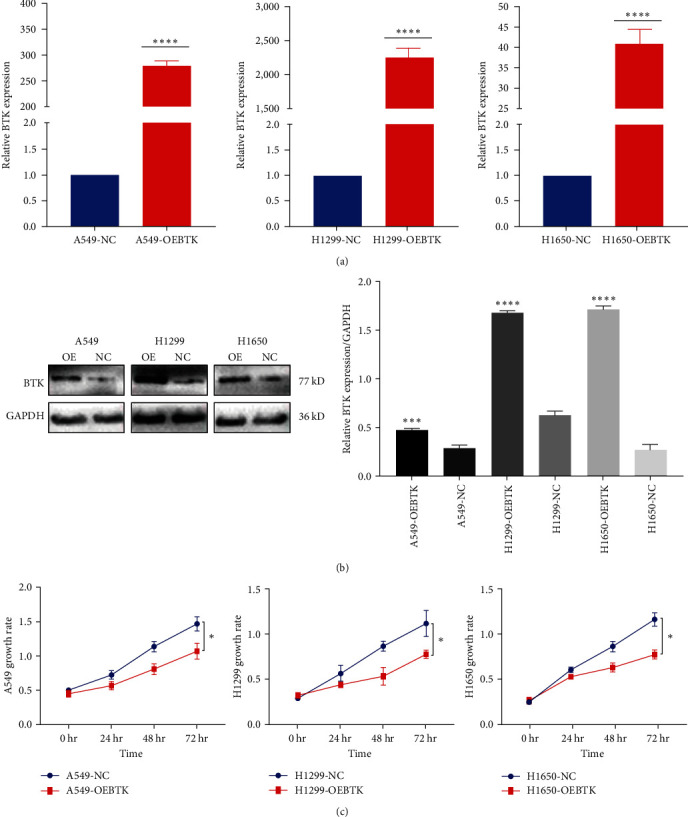 Overexpression of Bruton Tyrosine Kinase Inhibits the Proliferation, Migration, and Invasion of Non-Small Cell Lung Cancer Cells.