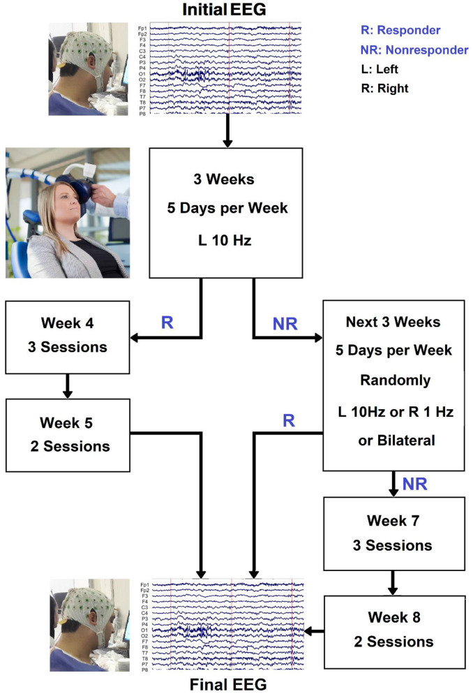 Machine learning approaches and non-linear processing of extracted components in frontal region to predict rTMS treatment response in major depressive disorder.