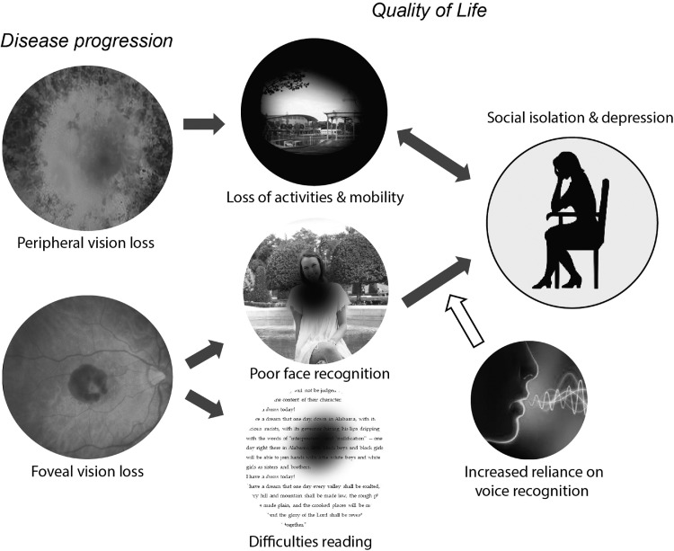 The impact of low vision on social function: The potential importance of lost visual social cues