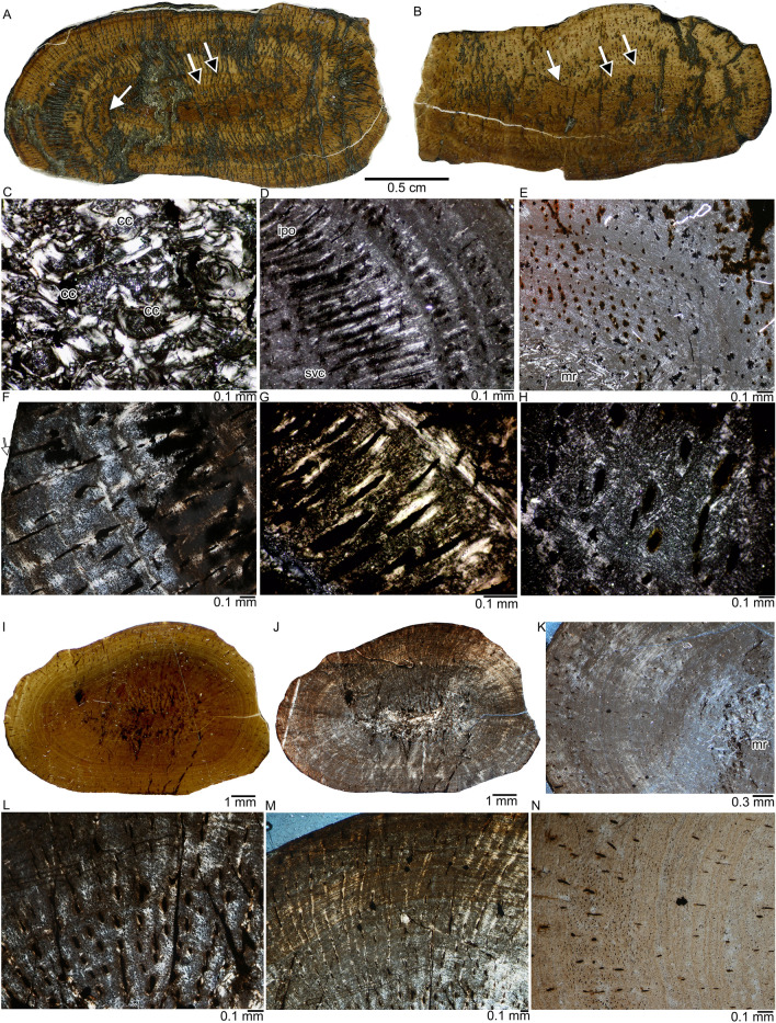 Comparative bone histology of two thalattosaurians (Diapsida: Thalattosauria): <i>Askeptosaurus italicus</i> from the Alpine Triassic (Middle Triassic) and a Thalattosauroidea indet. from the Carnian of Oregon (Late Triassic).