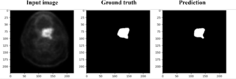 Auto-segmentation of head and neck tumors in positron emission tomography images using non-local means and morphological frameworks.