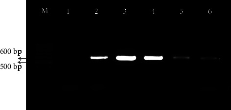 First Evidence of Fowl Adenovirus Induced Inclusion Body Hepatitis in Chicken in Bangladesh.