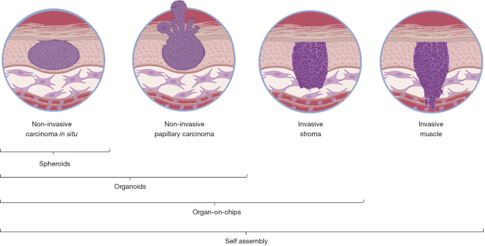 Recreating heterogeneity of bladder cancer microenvironment to study its recurrences and progression.