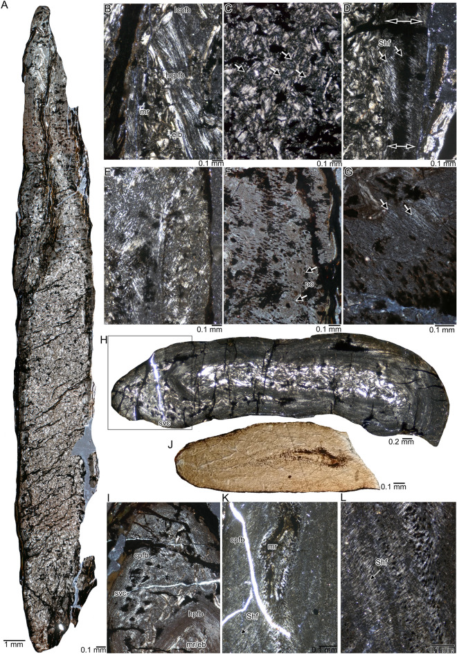 Comparative bone histology of two thalattosaurians (Diapsida: Thalattosauria): <i>Askeptosaurus italicus</i> from the Alpine Triassic (Middle Triassic) and a Thalattosauroidea indet. from the Carnian of Oregon (Late Triassic).